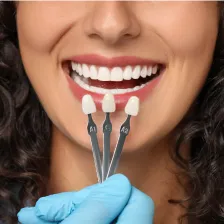 Dental Veneers Services at [practice_name] in [city], [st]